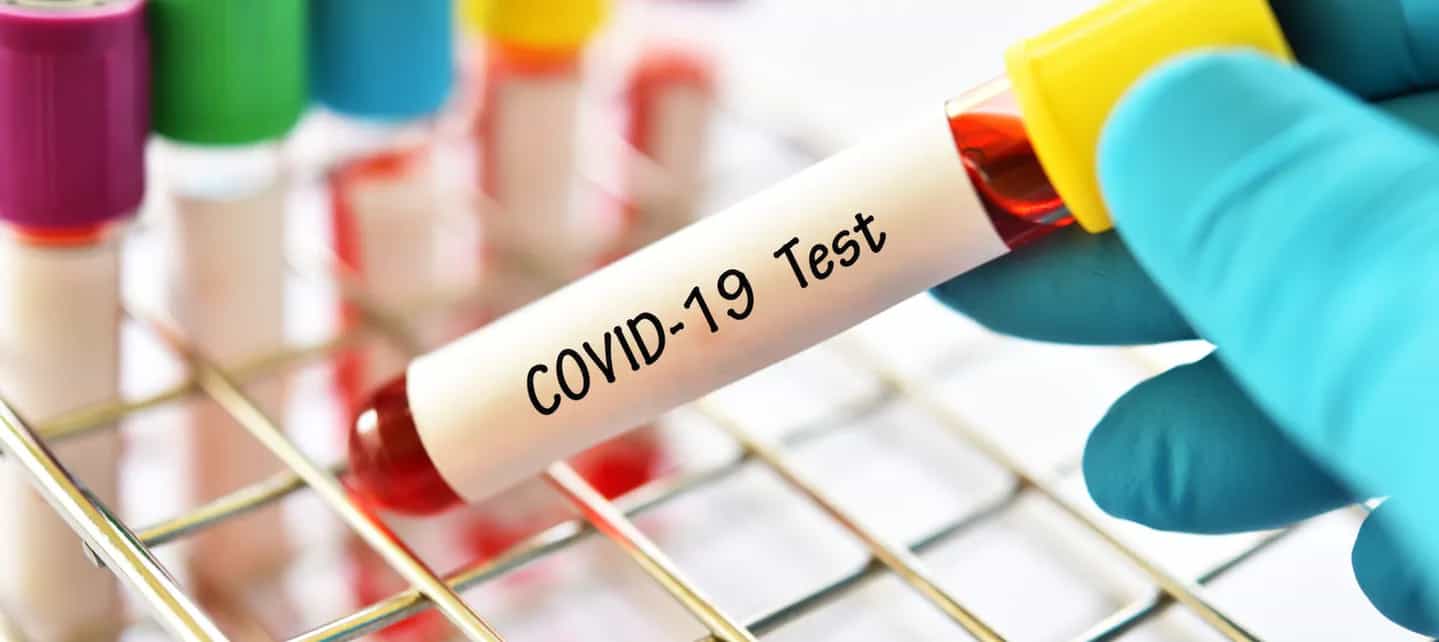 Bilde av en hånd som holder en Covid-19 test